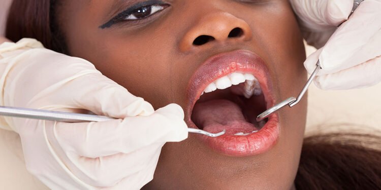 Angola conta com apenas 4.500 dentistas para 21 províncias